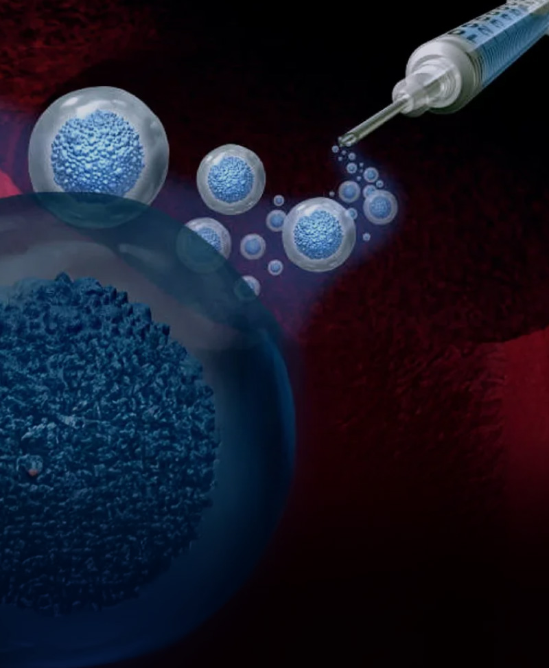 The-Laureatte-Exosome-Therapy-FA